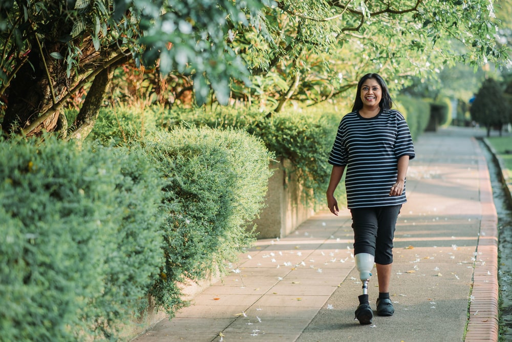 Women walking with a prosthetic leg